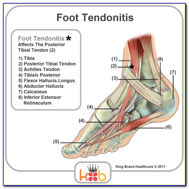 Achilles Tendon Injury Diagram
